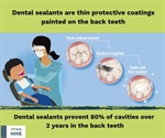 🦷 Dental Sealants: A Simple Way to Protect Smiles 🦷